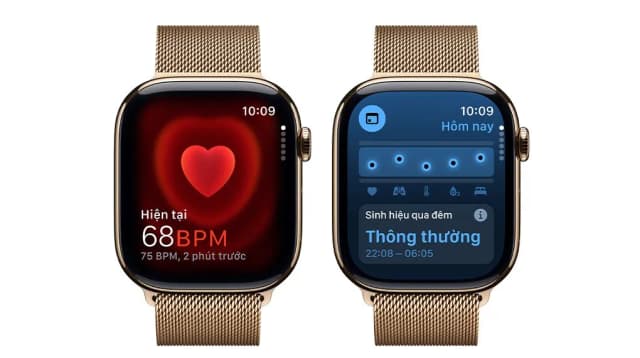 Top 1 so sánh giá Apple Watch Series 10 GPS + Cellular 42mm viền Titanium dây Milan - Tìm sản phẩm giá rẻ nhất - Ảnh 63