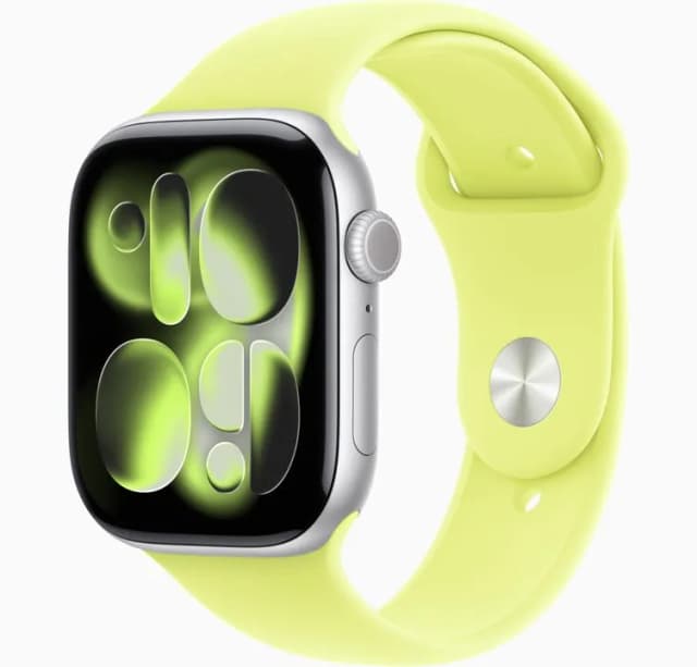 So sánh giá Apple Watch Series 11 GPS + Cellular 46mm viền nhôm dây thể thao rẻ nhất? - Ảnh 6